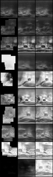 Carotid Plaque Risk Assessment – screenshot 3
