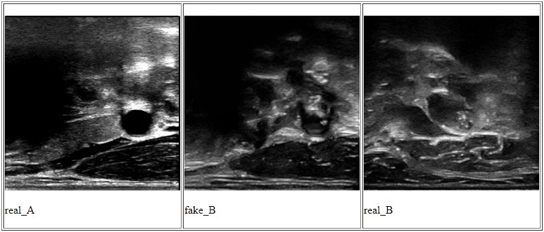 Carotid Plaque Risk Assessment – screenshot 4