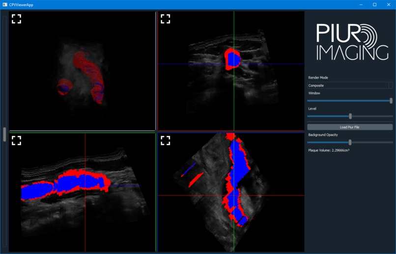 Carotid Plaque Risk Assessment – screenshot 1
