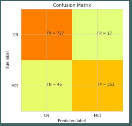 Early on-set detection of Alzheimer's disease from MRI scan – screenshot 4