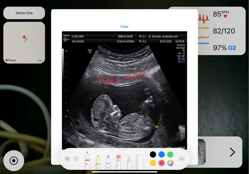 TeleTrauma – screenshot 2