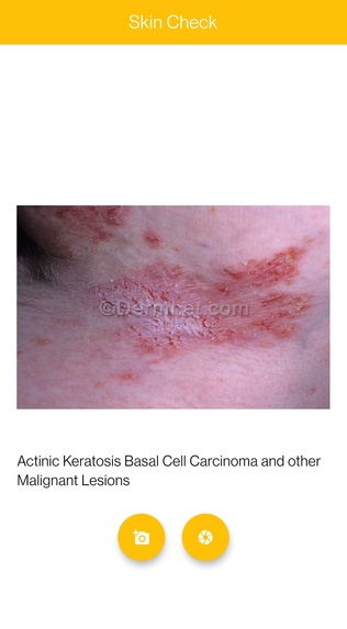 SkinCheck – screenshot 2