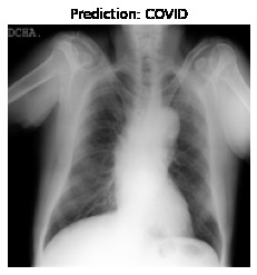 COVID-19 Detection through Radiography images of Lung CT. – screenshot 3