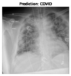 COVID-19 Detection through Radiography images of Lung CT. – screenshot 4