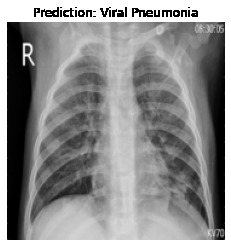 COVID-19 Detection through Radiography images of Lung CT. – screenshot 6