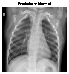 COVID-19 Detection through Radiography images of Lung CT. – screenshot 8