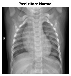 COVID-19 Detection through Radiography images of Lung CT. – screenshot 7