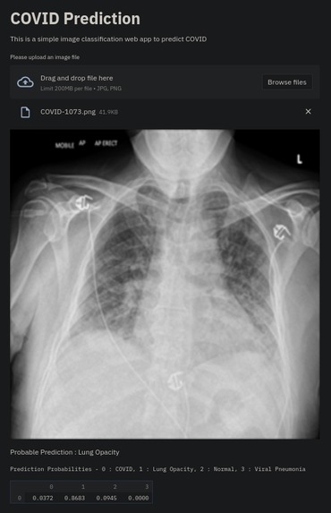 COVID-19 Detection through Radiography images of Lung CT. – screenshot 2