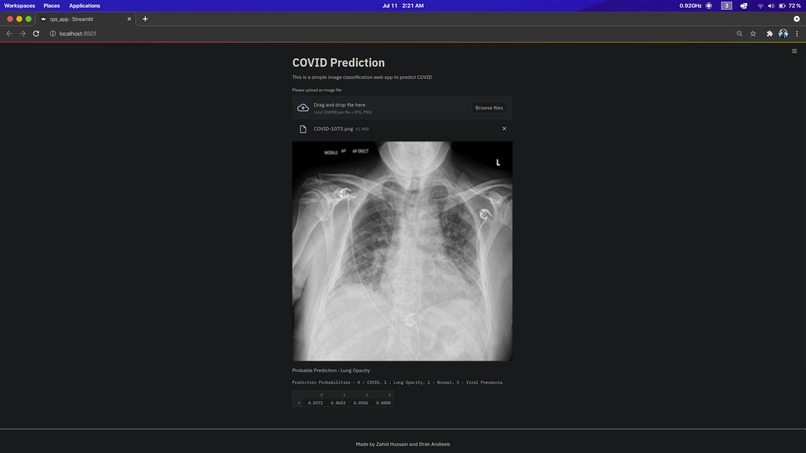 COVID-19 Detection through Radiography images of Lung CT. – screenshot 9