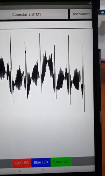 ECG – screenshot 5