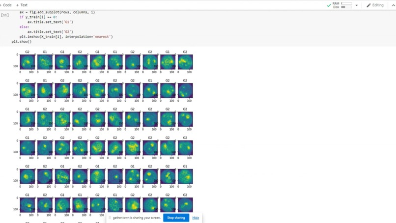 Leukemia Cancer Stage Detection  – screenshot 6