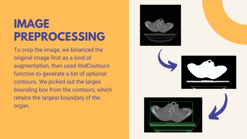 AlphaTau Seed Segmentation Using Unet – screenshot 3