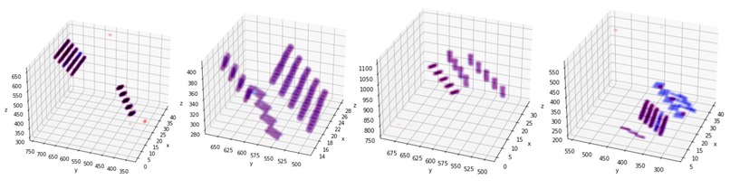 CT Image Segmentation – screenshot 14