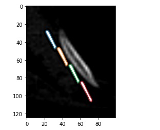 We Have an Idea – screenshot 1