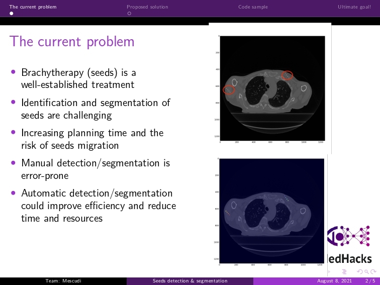 AutomaticSeedDetection – screenshot 2