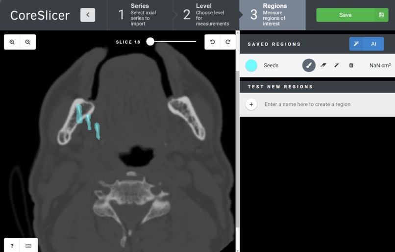CoreSeed – screenshot 1