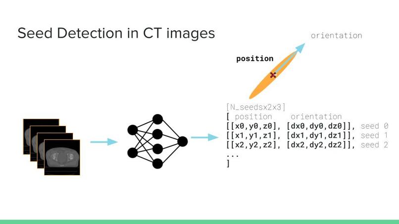 CT Image Segmentation – screenshot 1