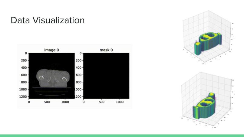 CT Image Segmentation – screenshot 2