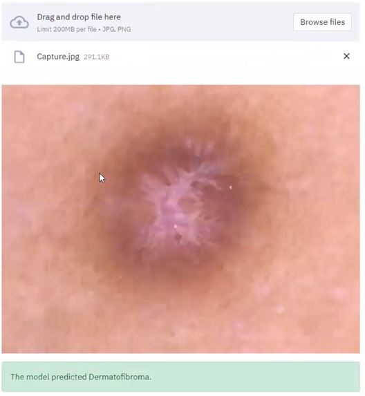 Fleshed Out – screenshot 3