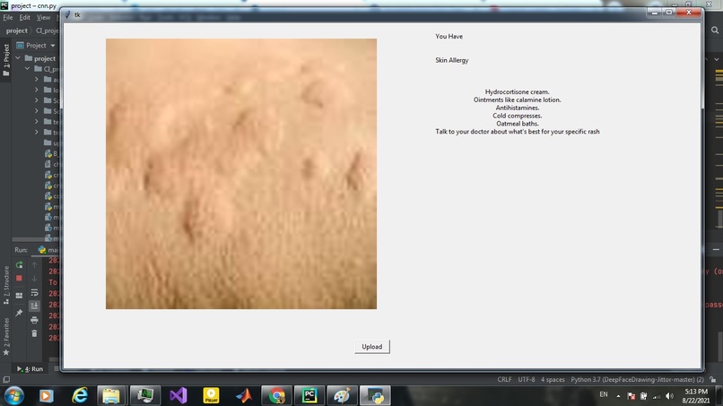 Skin Diagnosis  – screenshot 1