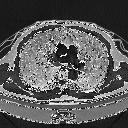 Covid-19 CT Scan Reader – screenshot 1