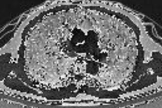 Covid-19 CT Scan Reader