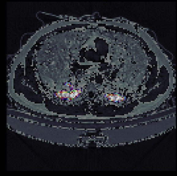 Covid-19 CT Scan Reader – screenshot 2