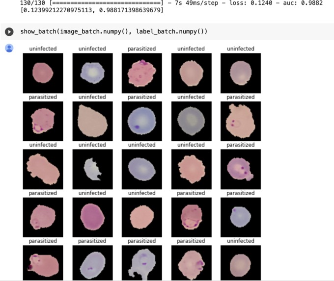 Detecting Malaria-Infected Blood Cells with Machine Learning – screenshot 3