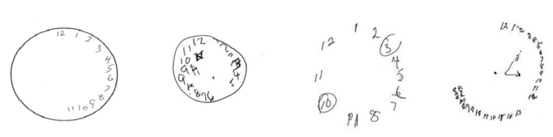 Detect Neurological problems – screenshot 3