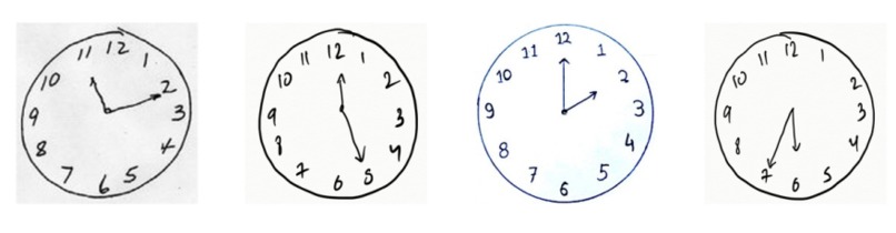 Detect Neurological problems – screenshot 5