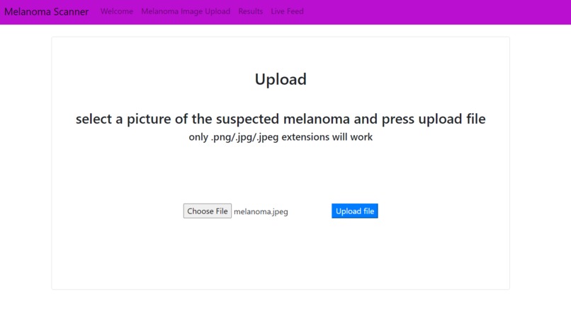 Melanoma Detection – screenshot 2