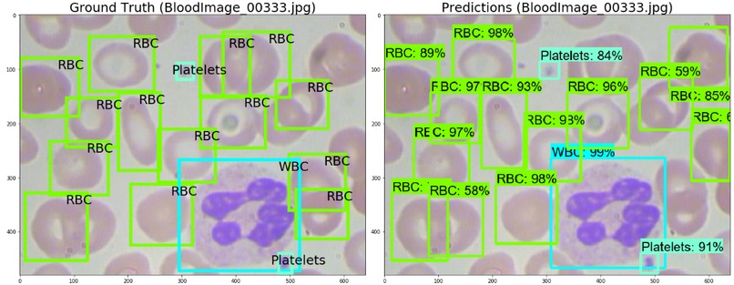 Dirty Blood : a blood cell classifier app – screenshot 7