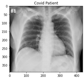 Covid/Pneumonia X-Ray Image Classifier – screenshot 2