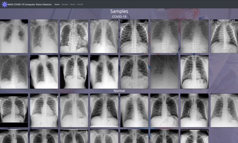 COVID 19 X-Ray Detector – screenshot 3