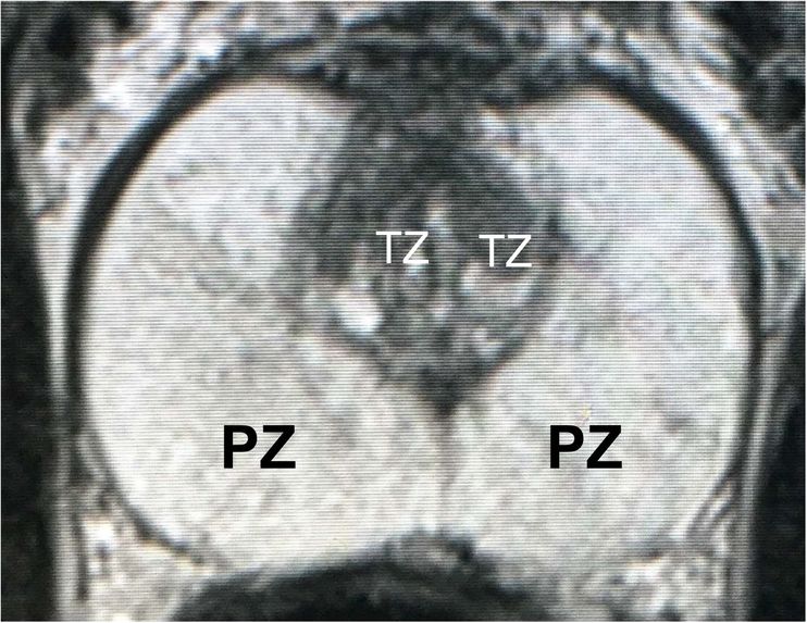 Image Segmentation for Prostate MRI – screenshot 2