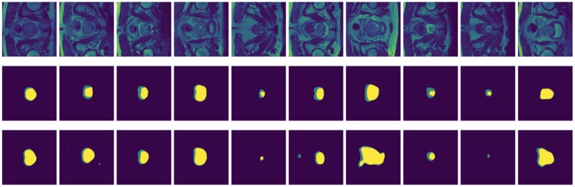 Image Segmentation for Prostate MRI – screenshot 12