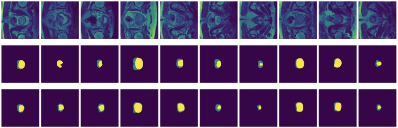 Image Segmentation for Prostate MRI – screenshot 11