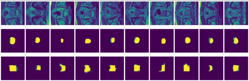 Image Segmentation for Prostate MRI – screenshot 9