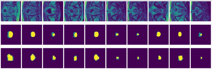 Image Segmentation for Prostate MRI – screenshot 10