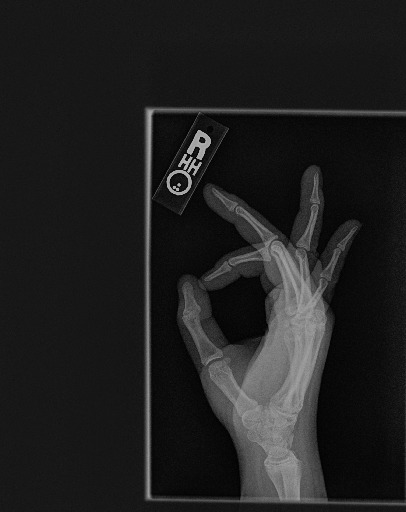 BoneyBoney – screenshot 1