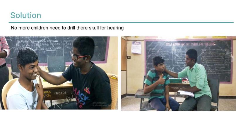 Adhesive Non Surgical Hearing Device – screenshot 5