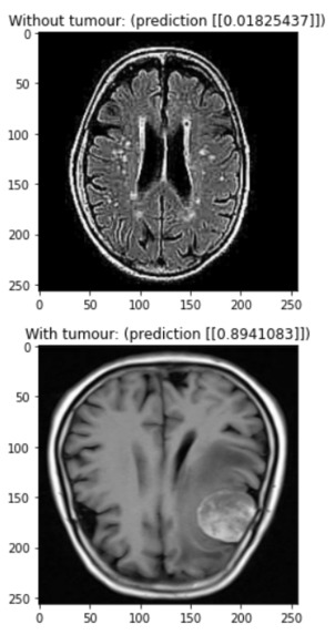 BrAIn – screenshot 7