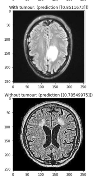BrAIn – screenshot 8