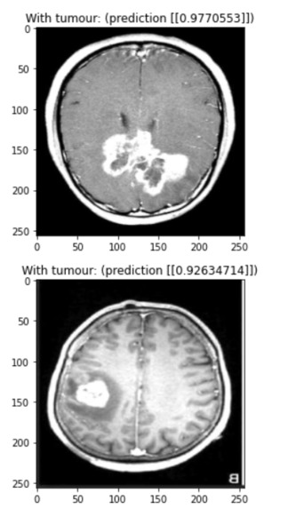BrAIn – screenshot 9