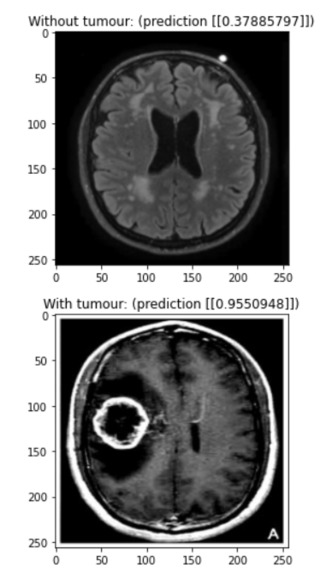 BrAIn – screenshot 10