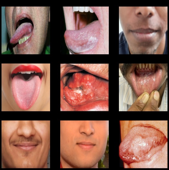 A Diagnostic Approach for Oral Cancer Based on Image Scans – screenshot 1