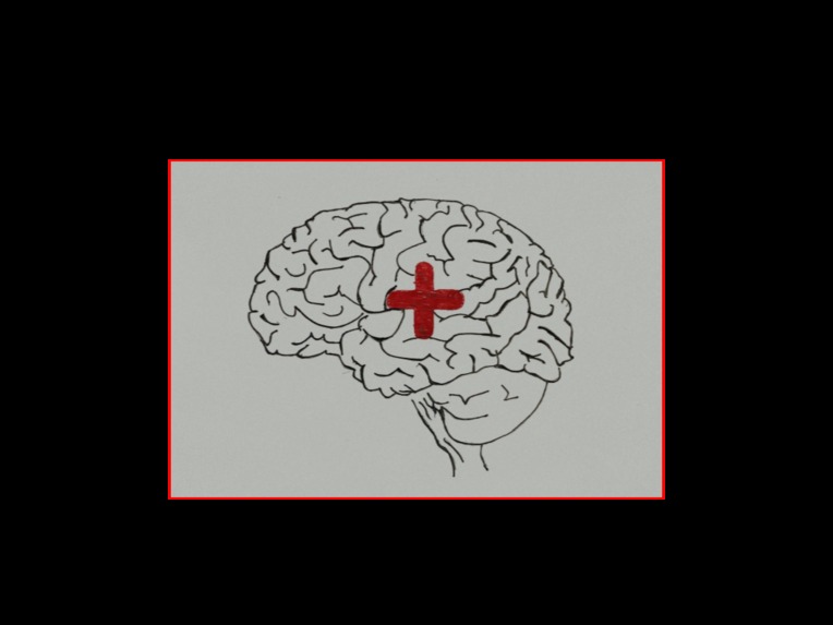 Mental Health First (AI)der  – screenshot 1