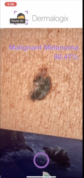 Dermalogix – screenshot 3