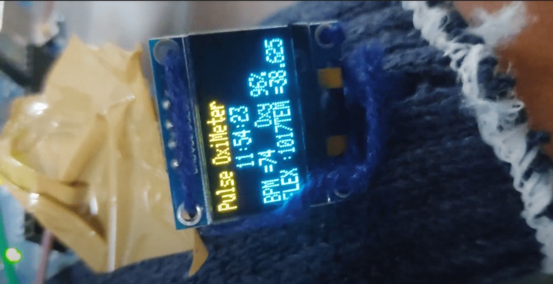 Smart health Glove – screenshot 1