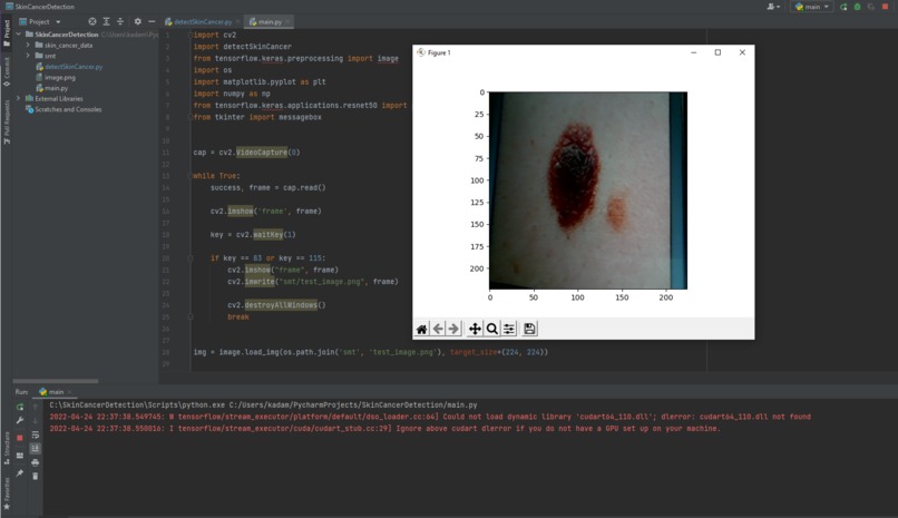 Skin-Cancer Detector – screenshot 1